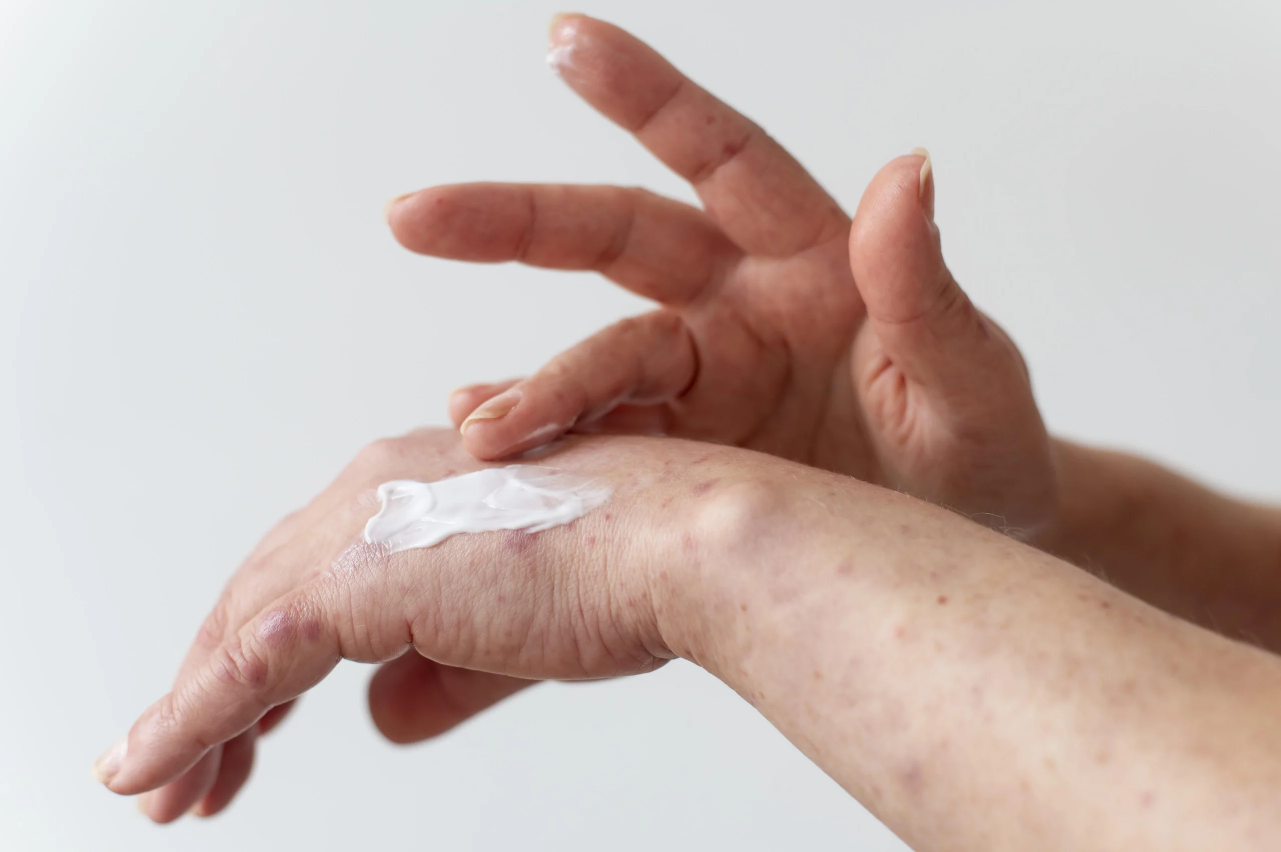A close-up of a hand applying a creamy skincare product to the wrist, highlighting the importance of moisturizing and nourishing the skin, especially for those curious about what causes dry skin.